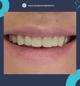Slider image (9) Dr. Aleksandar Kovacevic - Dental Clinic in Croatia